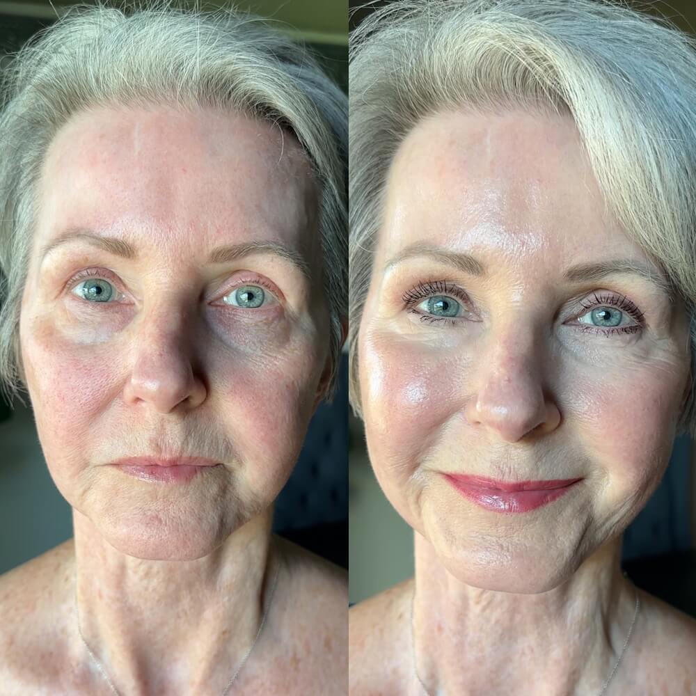 Finally, a serum that can fight Ozempic-face